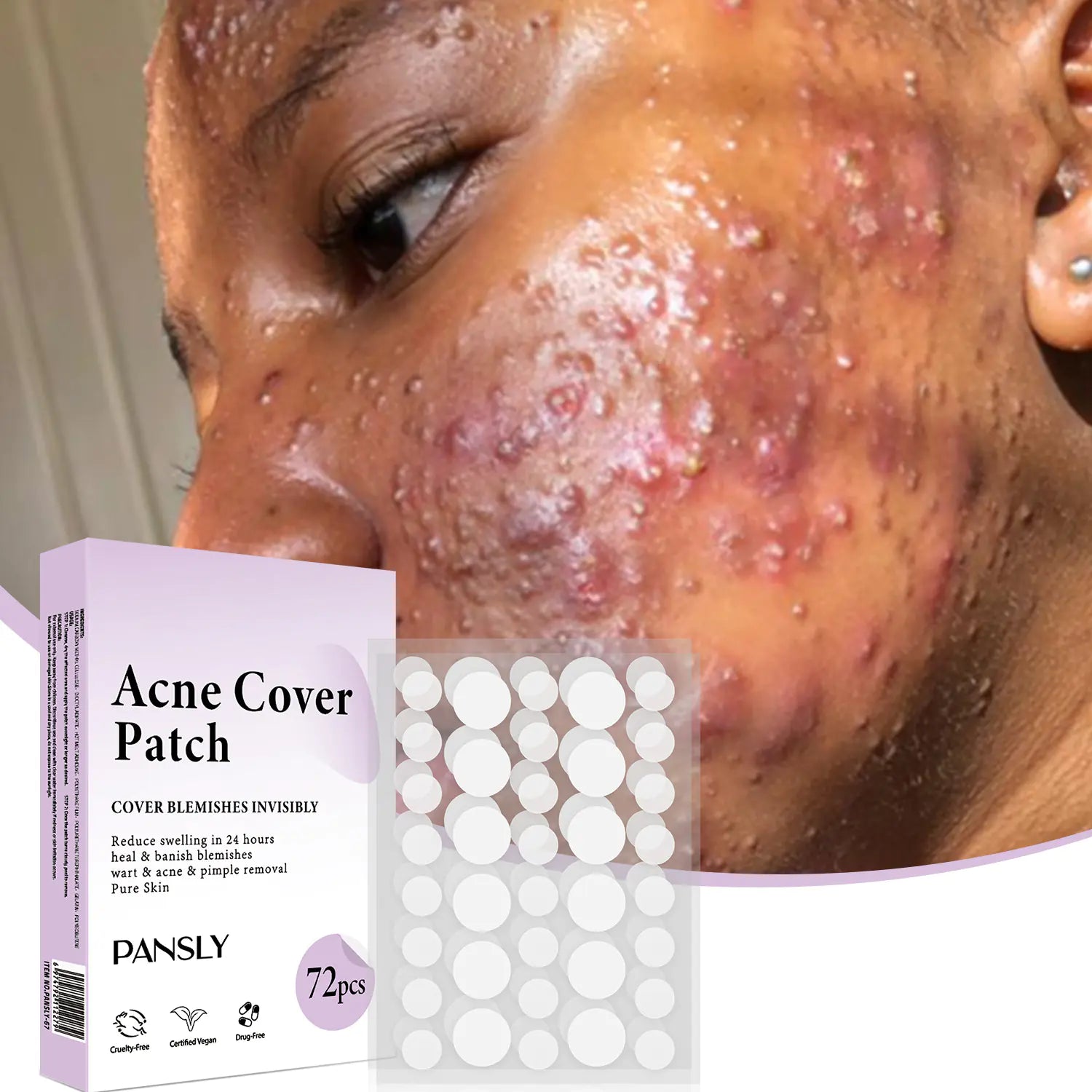 acne patch skin care product front view